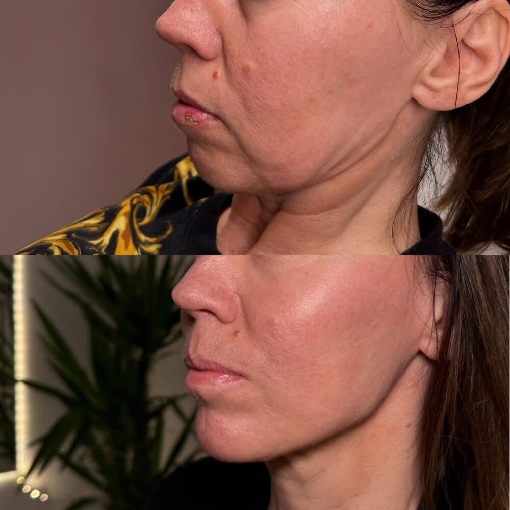 Metamorfoza klientki — efekt zabiegu LOOK BETTER